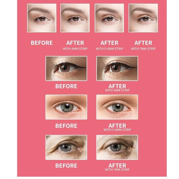 🆕 Medical Grade Instant Eyelid Tape Strips 4mm 100 ct - Picture 2 of 6